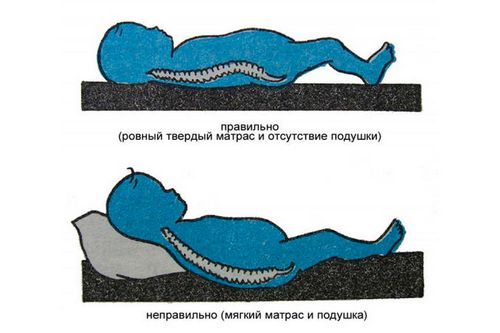 Детские ортопедические матрасы (35 фото): беспружинный вариант в кроватку для детей, 80 х 160 и другие размеры, как выбрать