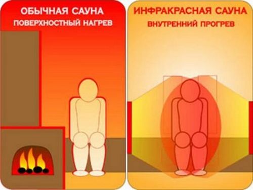 Противопоказания инфракрасной сауны